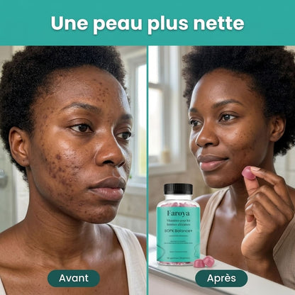 SOPK Balance+ Équilibre Hormonal, Cycles Réguliers et Peau Plus Nette