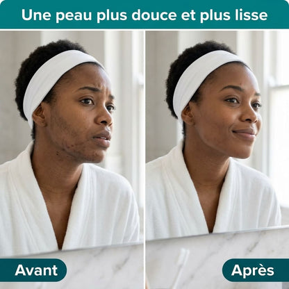 SOPK Balance+ Équilibre Hormonal, Cycles Réguliers et Peau Plus Nette