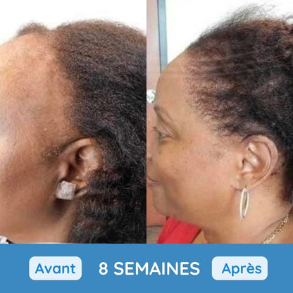 Sérum Ampoule Revitalisant Capillaire