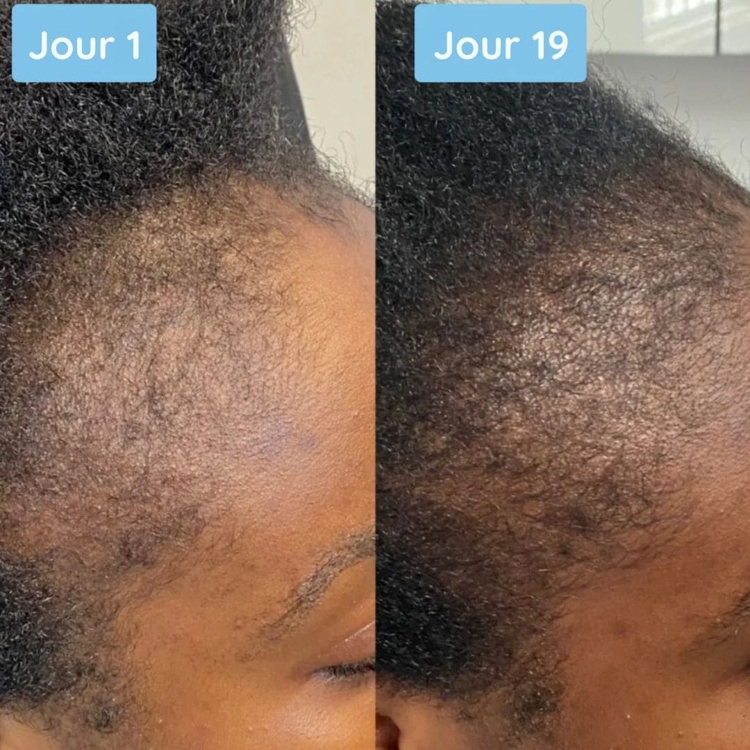 Sérum Ampoule Revitalisant Capillaire